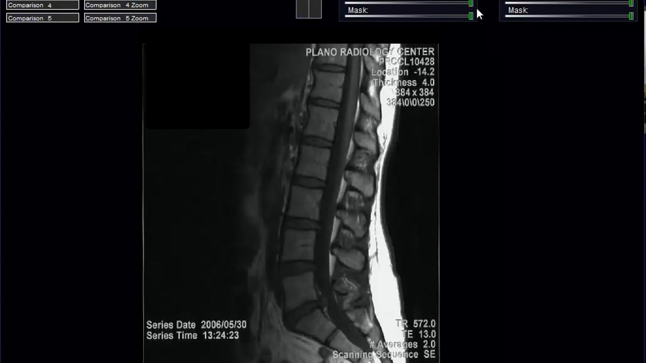 MRI Comparison Viewer