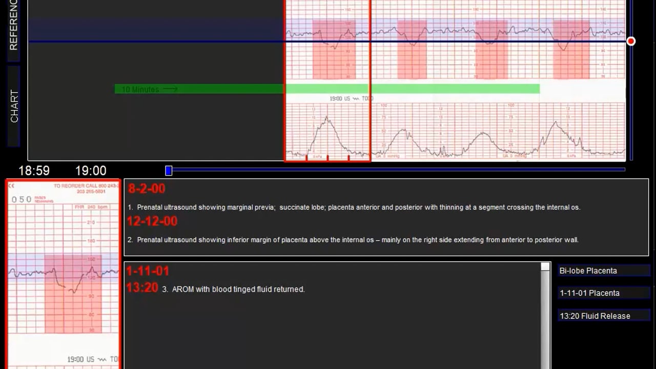 Fetal Heart Rate Viewer